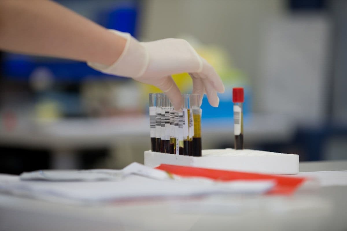 A gloved hand holding a filled blood sample tube
