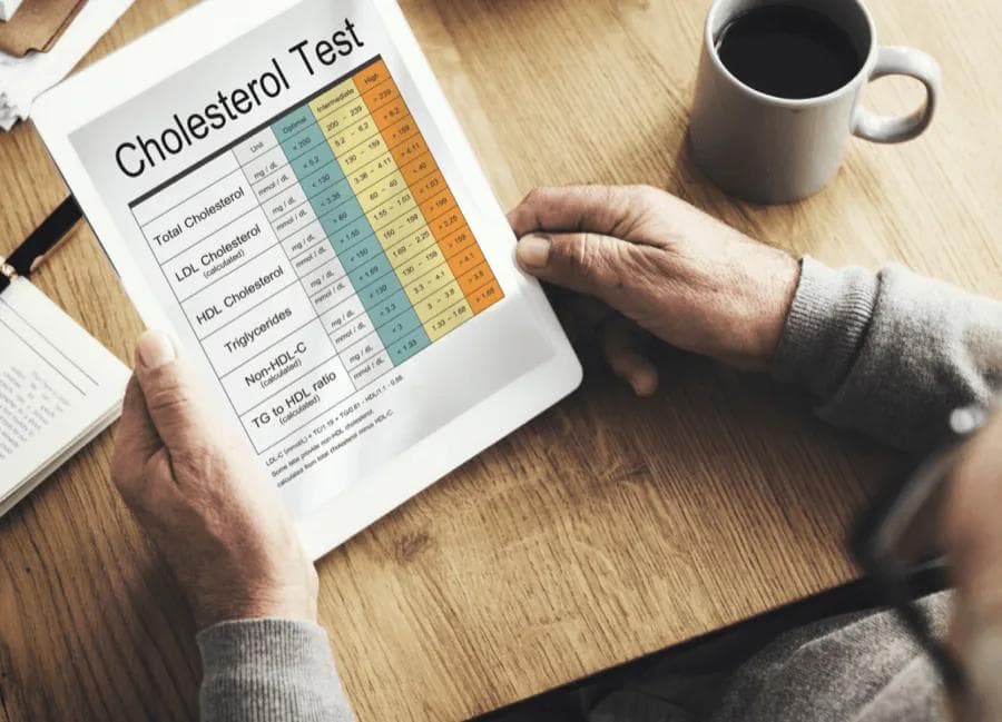 Cholesterol Test
