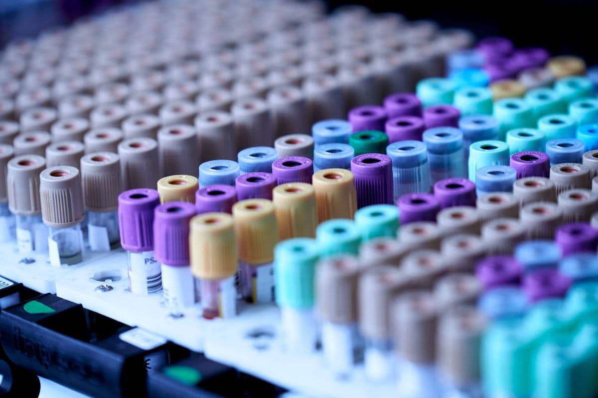 Coloured laboratory sample bottles