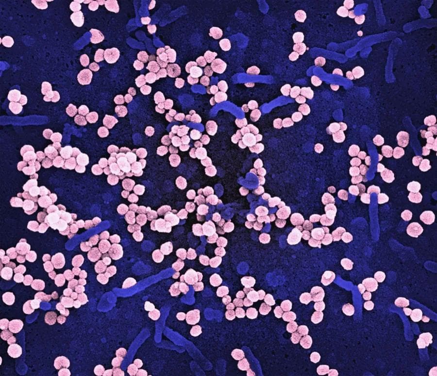 Hepatitis B Antibodies Test