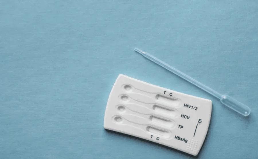 HIV, Hepatitis B/C and Syphilis Test