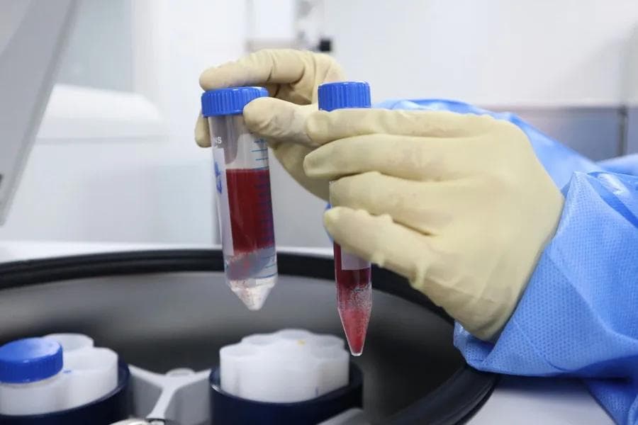 Female Hormone Blood Test