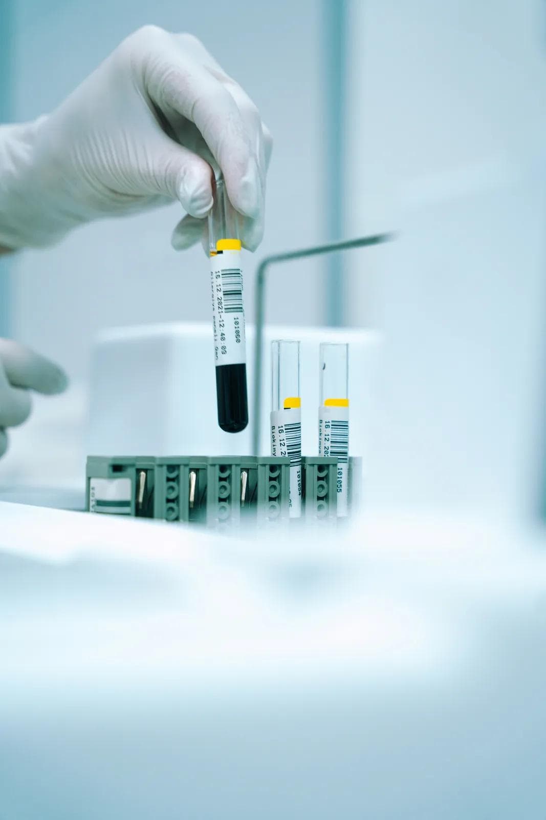 Blood Tests