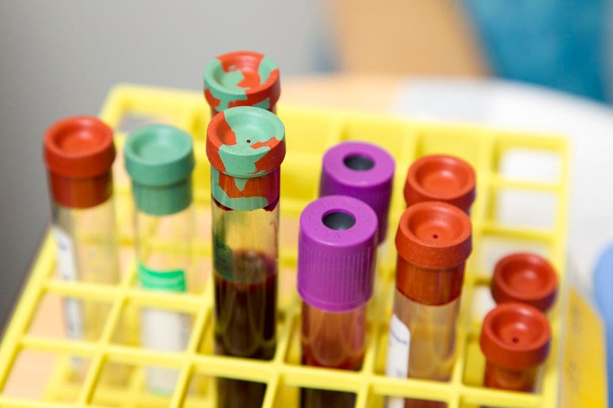 Clear glass laboratory test tubes in a rack